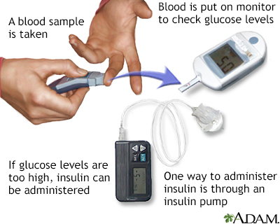 Insulin test